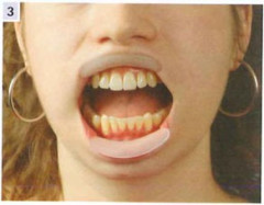 APRIBOCCA H&W SPANDEX-VERT KIT X 4