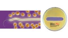 AGHI ETH. VCP303H RB1 5-0 X36 VICRYL PLUS - Dental Trey