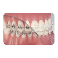 ARCHI NITI ESTETICI L 19X25 10 PZ - Dental Trey