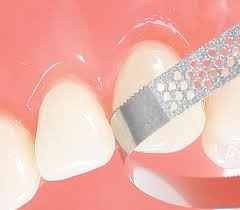 STRISCE EDENTA PFXDS3 30UM X10